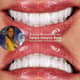 Slider image (10) Sonrisa Perfecta Dental